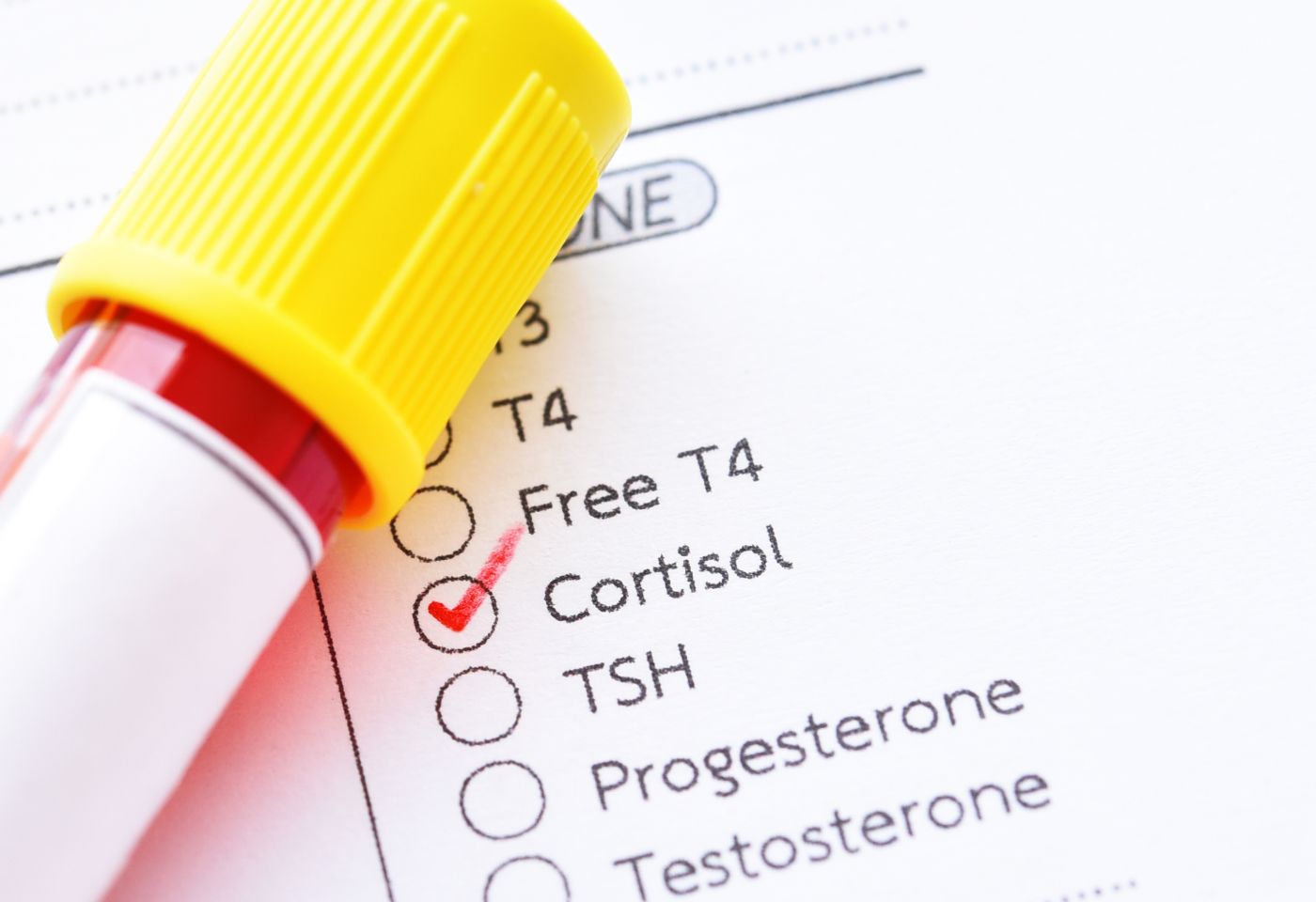 Best Supplements to Reduce Cortisol